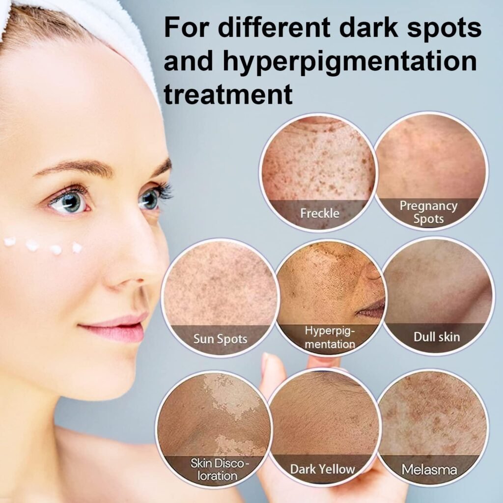 cream for pigmentation